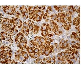 Squalene synthetase Antibody (C-10) - Immunohistochemistry - Image 159961 