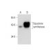 Squalene synthetase Antibody (C-10) - Western Blotting - Image 129858 