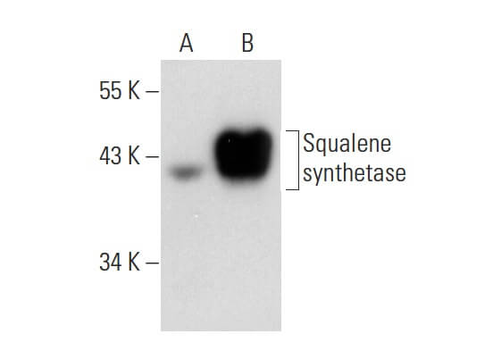 新作ウエア Antibody synthetase Squalene (C-10) Cruz Santa - SCBT | ピンズ・ピンバッジ・缶バッジ