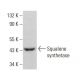 Squalene synthetase Antibody (C-10) - Western Blotting - Image 382639