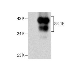 SR-1E Antibody (D-9) - Western Blotting - Image 286786