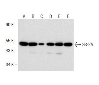 western blotting image from recommended SR-2A (A-4) monoclonal antibody replacement. Image 148858
