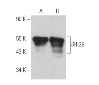 western blotting image from recommended SR-2B (C-6) monoclonal antibody replacement. Image 358934