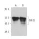 western blotting image from recommended SR-2B (C-6) monoclonal antibody replacement. Image 358934