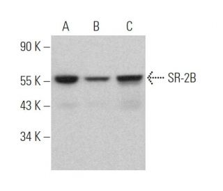 SR-2B Antibody (C-6) - Western Blotting - Image 368429