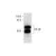 SR-3B Antibody (H-9) - Western Blotting - Image 295810 