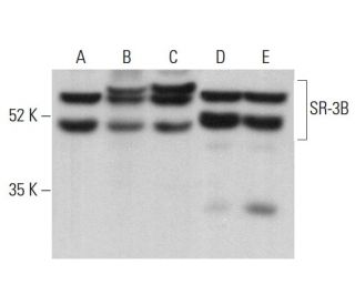 SR-3B Antibody (H-9) - Western Blotting - Image 376335 