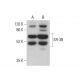 SR-3B Antibody (H-9) - Western Blotting - Image 376338