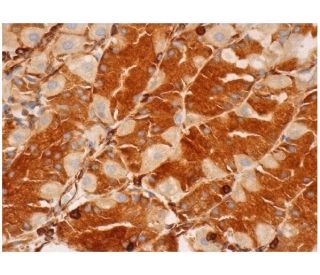 immunohistochemistry image from recommended SR-4 (G-3) monoclonal antibody replacement. Image 286285