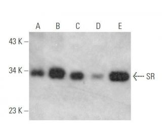 SR Antibody (1H4) - Western Blotting - Image 352712 