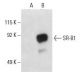 SR-B1 Antibody (F-12) - Western Blotting - Image 397681