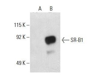 SR-B1 Antibody (F-12) - Western Blotting - Image 397681The Double Nickase Plasmid features a U6 promoter for sgRNA expression, a 20 nt targeting sequence, and a gRNA scaffold to guide Cas9n. It includes a CBh promoter for Cas9n (D10A) and puromycin resistance, GFP for transfection verification, and nuclear localization signals (NLS). The 2A peptide allows co-expression of Cas9n and Puro from a single promoter, enabling precise genome editing with reduced off-target effects. 