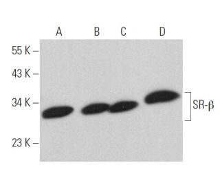 SR-&beta; Antibody (D-4) - Western Blotting - Image 368335 