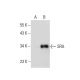 SRA Antibody (D-8) - Western Blotting - Image 135891