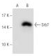 Srb7 Antibody (31-C) - Western Blotting - Image 47001