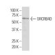 SRCRB4D Antibody (46-M) - Western Blotting - Image 33686 