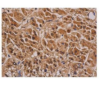 srebp-1-antibody-a-4- srebp-1-antibody-a-4-