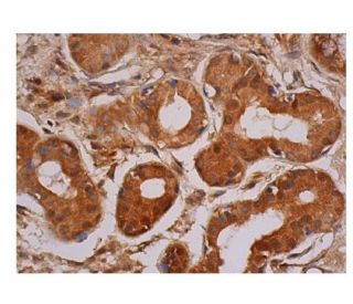 SREBP-1 Antibody (A-4) | SCBT - Santa Cruz Biotechnology