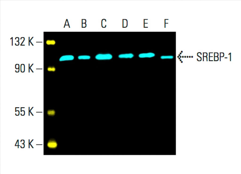 SREBP-1 Antibody (A-4) | SCBT - Santa Cruz Biotechnology SREBP-1 Antibody (A-4) | SCBT - Santa Cruz Biotechnology