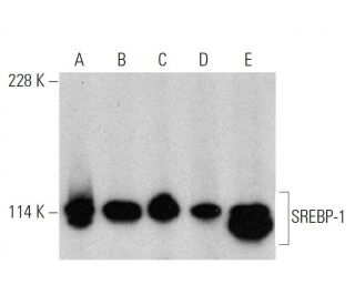 western blotting image from recommended SREBP-1 (A-4) monoclonal antibody replacement. Image 359561
