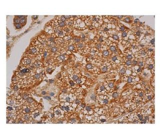 SREBP-1 Antibody (F-10) | SCBT - Santa Cruz Biotechnology