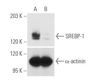 SREBP-1 siRNA (h): sc-36557. Western blot analysis of SREBP-1 expression in non-transfected control (A) and SREBP-1 siRNA 