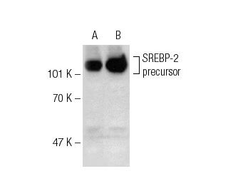 SREBP-2抗体(A-12) | SCBT - Santa Cruz Biotechnology
