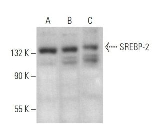 western blotting image from recommended SREBP-2 (1C6) monoclonal antibody replacement. Image 375166
