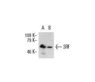 western blotting image from recommended serum reponse factor /SRF (A-11) monoclonal antibody replacement. Image 8678