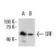 western blotting image from recommended serum reponse factor /SRF (A-11) monoclonal antibody replacement. Image 8678