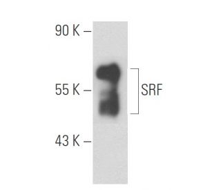 serum reponse factor /SRF Antibody (SRF01 (SR28) - Western Blotting - Image 57862 