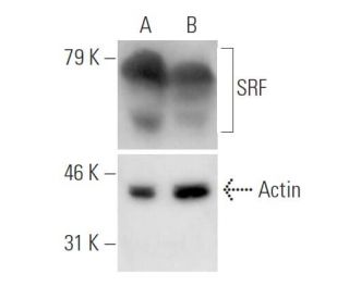 SRF siRNA (h): sc-36563. Western blot analysis of SRF expression in non-transfected control (A) and SRF siRNA transfected 