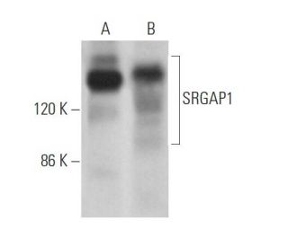 SRGAP1 Antibody (D-11) - Western Blotting - Image 372859 