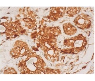 SRMS Antibody (A-4) - Immunohistochemistry - Image 286459 