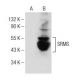 SRMS Antibody (A-4) - Western Blotting - Image 150981