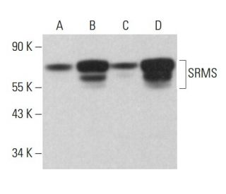 SRMS Antibody (E-5) - Western Blotting - Image 382671 
