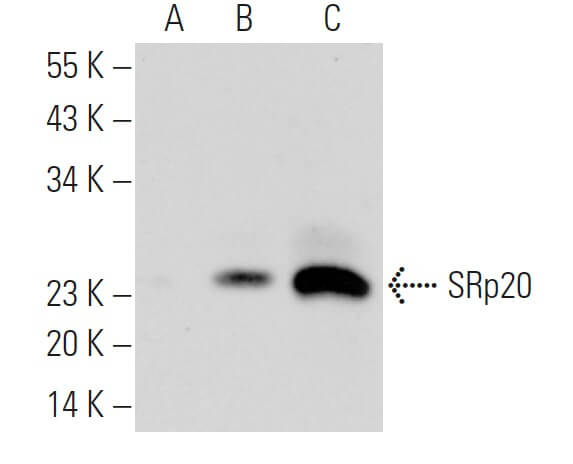 Anti-SRp20 Antibody (7B4) | SCBT - Santa Cruz Biotechnology