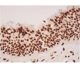 SRp55 Antibody (16H3) - Immunohistochemistry - Image 293422 
