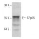 SRp55 Antibody (C-6) - Western Blotting - Image 354024 