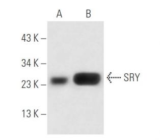 SRY Antibody (SRY-15) - Western Blotting - Image 15789Each CRISPR/Cas9 Knockout (KO) Plasmid product consists of a pool of 3 plasmids designed to ensure identification and cleavage of a specific gene for maximum knockout efficiency. Each plasmid encodes a unique 20 nt sequence derived from the GeCKO (v2) library.