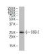 SSB-2 Antibody (32-K) - Western Blotting - Image 34236 