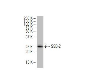 SSB-2 Antibody (32-K) - Western Blotting - Image 34236The Double Nickase Plasmid features a U6 promoter for sgRNA expression, a 20 nt targeting sequence, and a gRNA scaffold to guide Cas9n. It includes a CBh promoter for Cas9n (D10A) and puromycin resistance, GFP for transfection verification, and nuclear localization signals (NLS). The 2A peptide allows co-expression of Cas9n and Puro from a single promoter, enabling precise genome editing with reduced off-target effects.