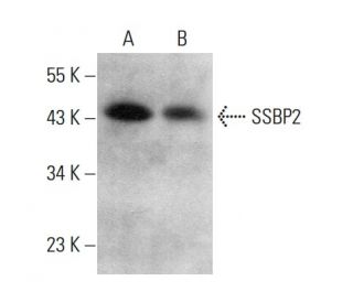 SSBP2 Antibody (D-3) - Western Blotting - Image 376305 