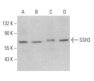 SSH3 Antibody (B-7) - Western Blotting - Image 365930 
