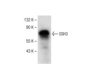 SSH3 Antibody (G-2) - Western Blotting - Image 151266 
