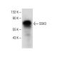 SSH3 Antibody (G-2) - Western Blotting - Image 151266 