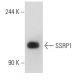 SSRP1 Antibody (3E4) - Western Blotting - Image 55073 