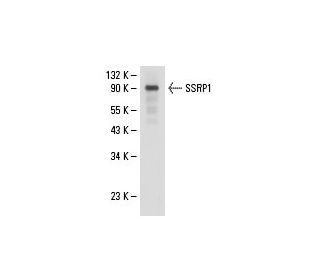 SSRP1 Antibody (D-7) - Western Blotting - Image 18293Each CRISPR/Cas9 Knockout (KO) Plasmid product consists of a pool of 3 plasmids designed to ensure identification and cleavage of a specific gene for maximum knockout efficiency. Each plasmid encodes a unique 20 nt sequence derived from the GeCKO (v2) library.