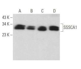 SSSCA1 Antibody (G-12) - Western Blotting - Image 371848 