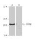 SSSCA1 Antibody (NB-C27) - Western Blotting - Image 65063